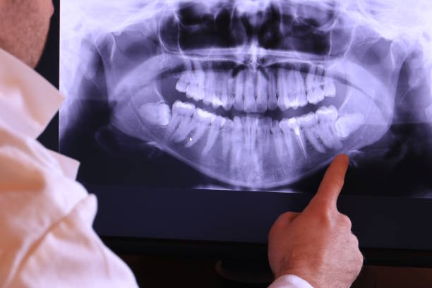 Best Emergency Gum Treatment in Poplar Grove, IL